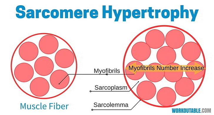 sarcomere hypertrophy