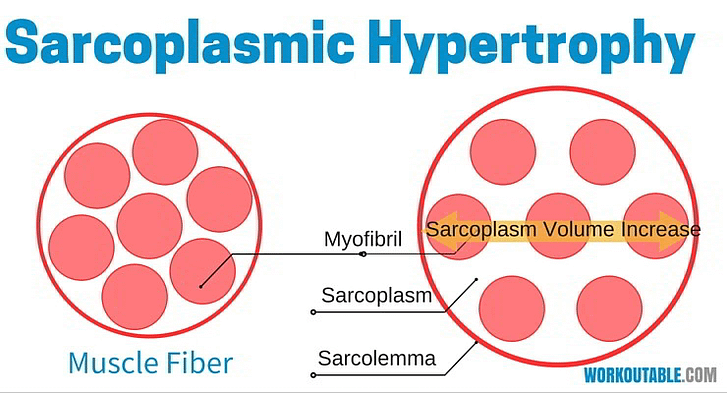 sarcoplasmic hypertrophy